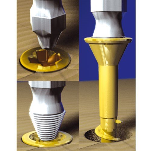 TREND TREND GRAB/SE1/SET 2pc Pro-Grabit Screw Remover Set